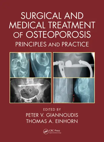 Cover of Surgical and Medical Treatment of Osteoporosis Principles and Practice