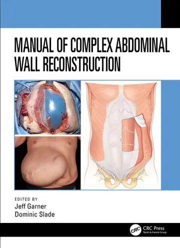 Cover of Manual of Complex Abdominal Wall Reconstruction