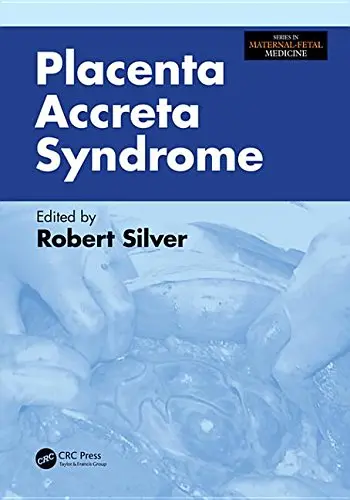 Cover of Placenta Accreta Syndrome