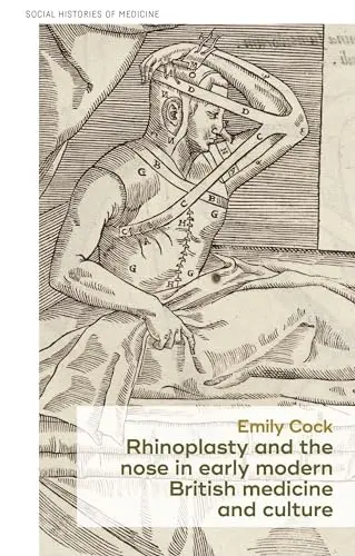 Cover of Rhinoplasty and the Nose in Early Modern British Medicine and Culture