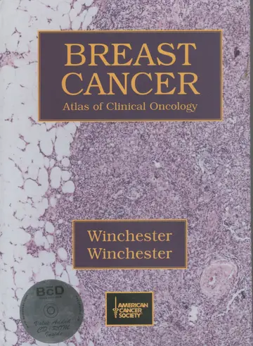 Cover of Breast Cancer