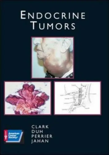 Cover of Endocrine Tumors