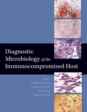 Cover of Diagnostic Microbiology of the Immunocompromised Host