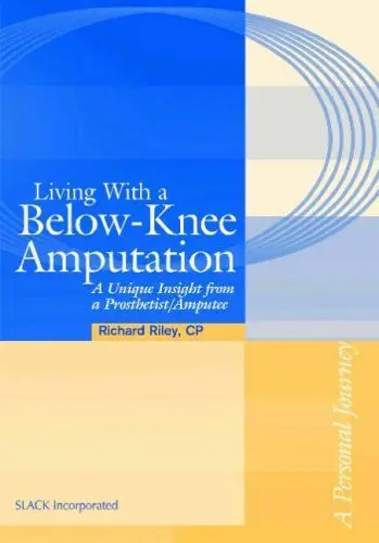 Cover of Living with a Below-knee Amputation