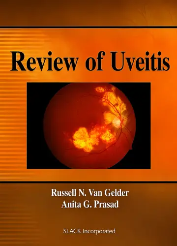 Cover of Review of Uveitis 1