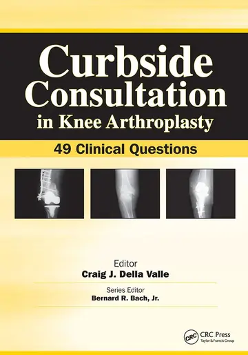 Cover of Curbside Consultation in Knee Arthroplasty