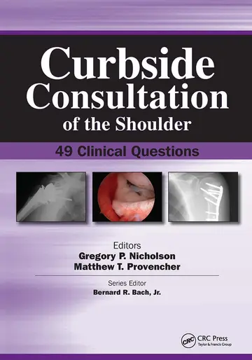 Cover of Curbside Consultation of the Shoulder