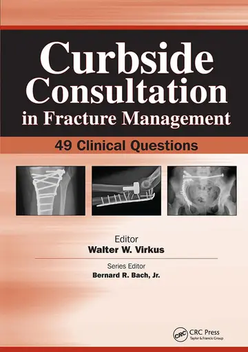 Cover of Curbside Consultation in Fracture Management