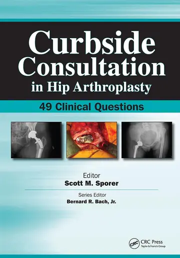Cover of Curbside Consultation in Hip Arthroplasty