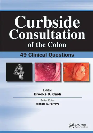 Cover of Curbside Consultation of the Colon