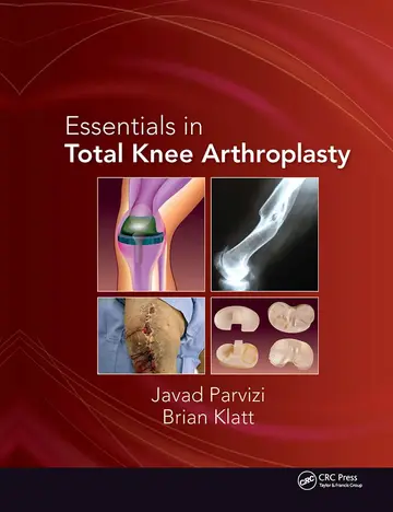 Cover of Essentials in Total Knee Arthroplasty