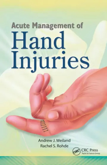Cover of Acute Management of Hand Injuries