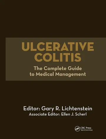 Cover of Ulcerative Colitis