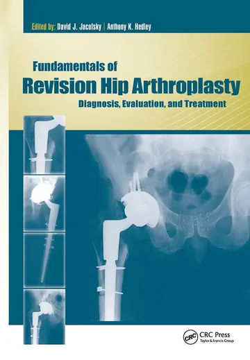 Cover of Fundamentals of Revision Hip Arthroplasty