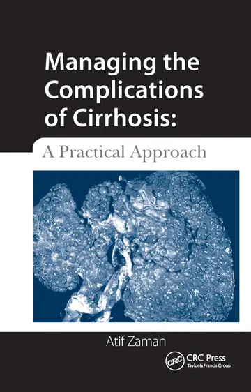 Cover of Managing the Complications of Cirrhosis