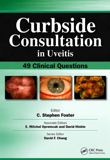 Cover of Curbside Consultation in Uveitis