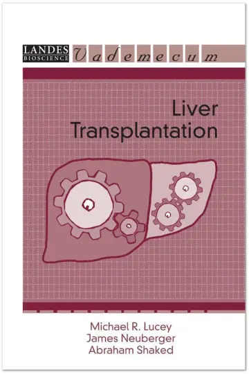 Cover of Liver Transplantation