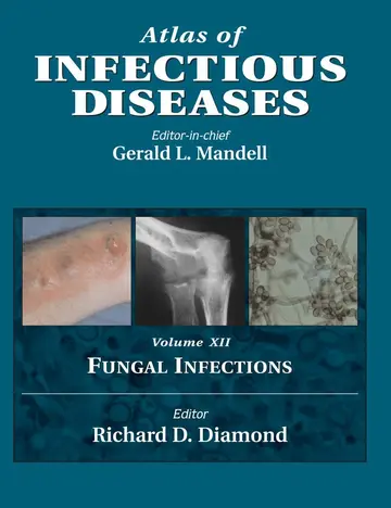 Cover of Atlas of Infectious Diseases