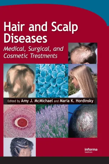 Cover of Hair and Scalp Diseases