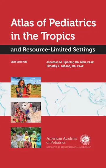 Cover of Atlas of Pediatrics in the Tropics and Resource-Limited Settings