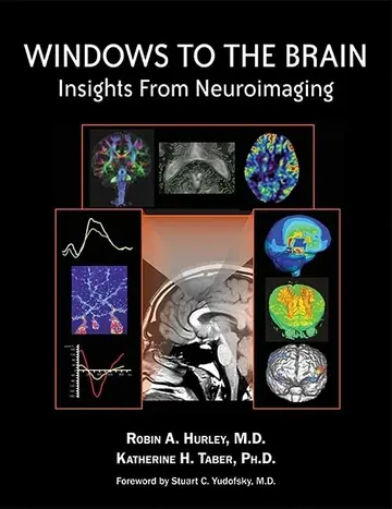 Cover of Windows to the Brain