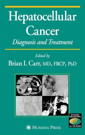 Cover of Hepatocellular Carcinoma