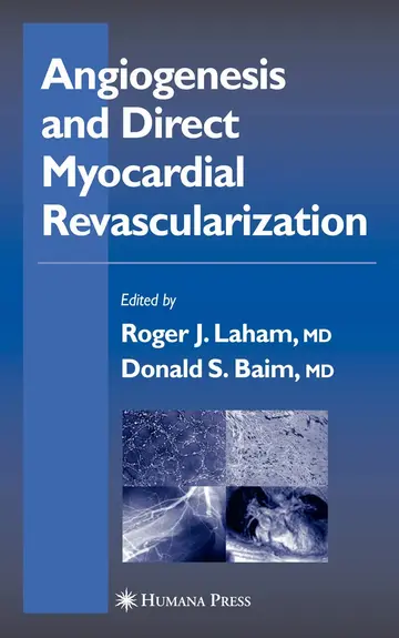 Cover of Angiogenesis and Direct Myocardial Revascularization