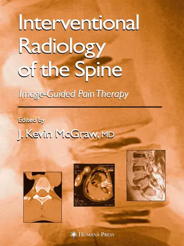 Cover of Interventional Radiology of the Spine