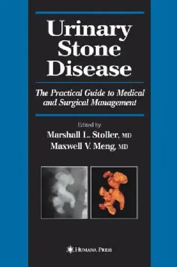 Cover of Urinary Stone Disease