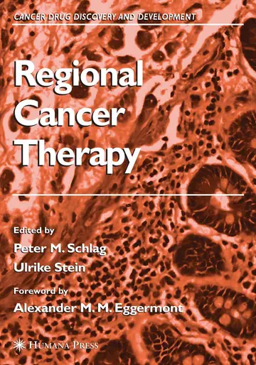Cover of Regional Cancer Therapy