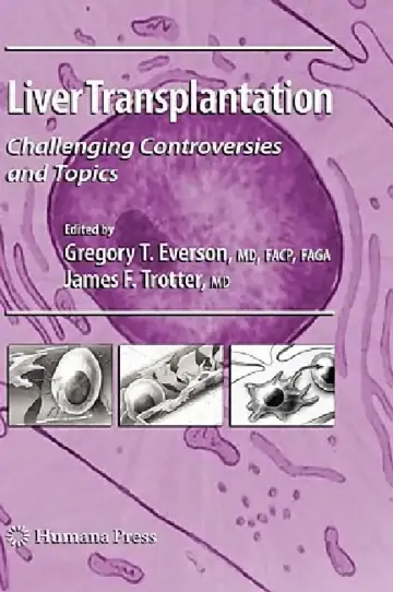 Cover of Liver Transplantation
