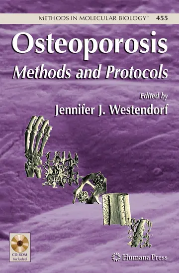 Cover of Osteoporosis