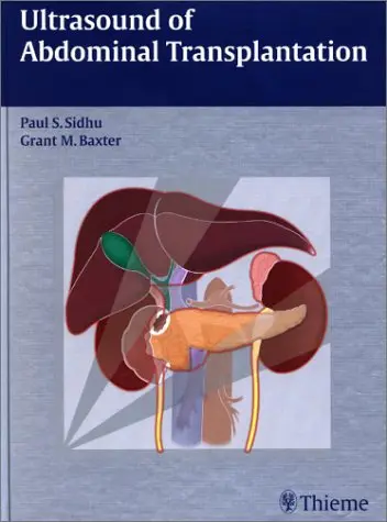 Cover of Ultrasound of Abdominal Transplantation / [Edited by] Paul S. Sidhu, Grant M. Baxter ; with Contributions by Syed Babar ... [Et Al.]