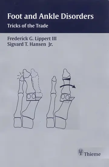 Cover of Foot and ankle disorders