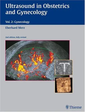Cover of Ultrasound in Obstetrics and Gynecology