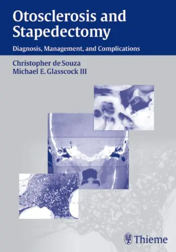 Cover of Otosclerosis and Stapedectomy