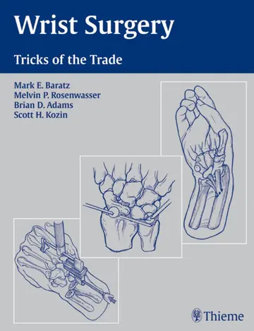 Cover of Wrist Surgery
