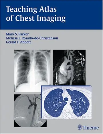 Cover of Teaching Atlas of Chest Imaging