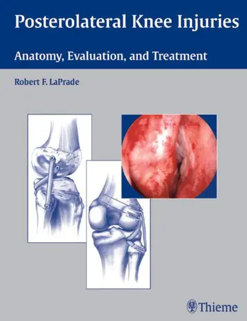 Cover of Posterolateral Knee Injuries
