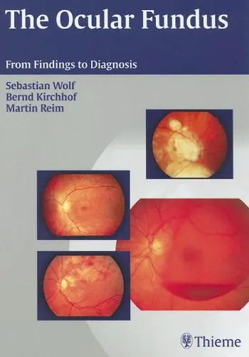 Cover of The Ocular Fundus