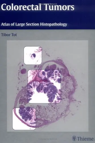 Cover of Colorectal Tumors