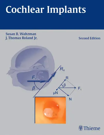 Cover of Cochlear Implants