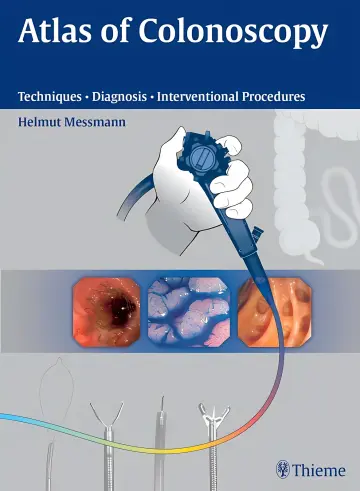 Cover of Atlas of Colonoscopy