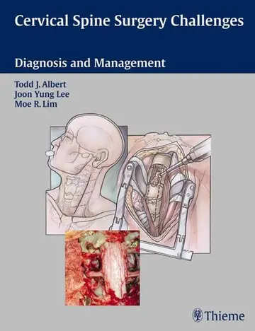 Cover of Cervical Spine Surgery Challenges