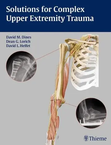 Cover of Solutions for Complex Upper Extremity Trauma