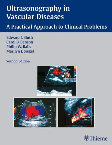 Cover of Ultrasonography in Vascular Diseases