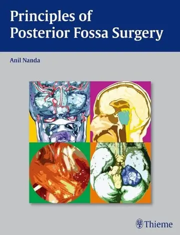 Cover of Principles of Posterior Fossa surgery