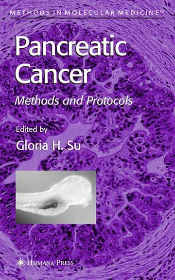 Cover of Pancreatic Cancer