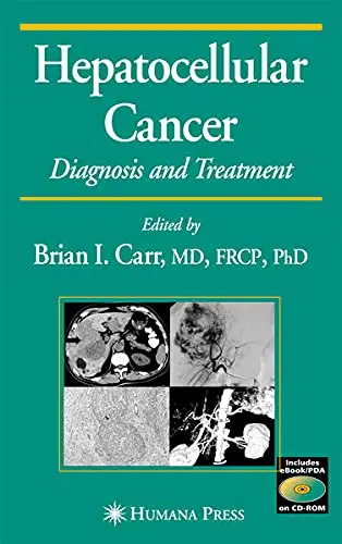 Cover of Hepatocellular Cancer