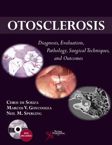 Cover of Otosclerosis